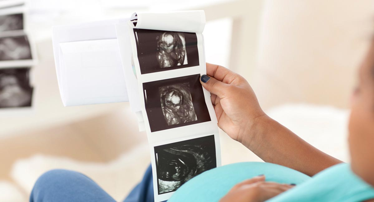  بهترین زمان تعیین جنسیت جنین با سونوگرافی