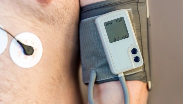 هولتر فشار خون چیست؟