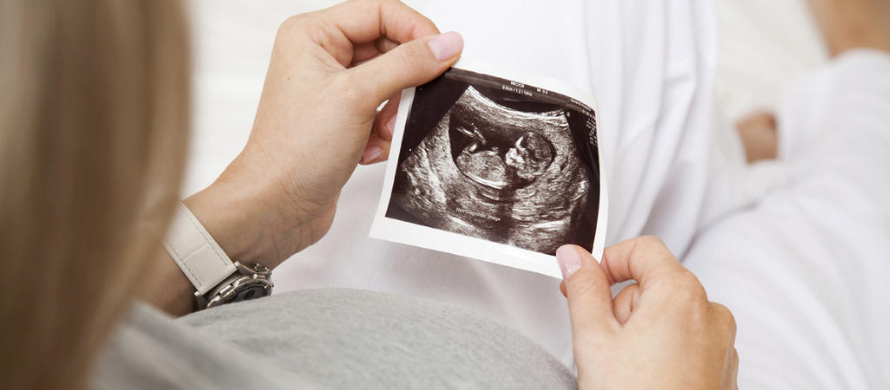 نکات پایانی در رابطه با آزمایش های سونوگرافی در دوران بارداری