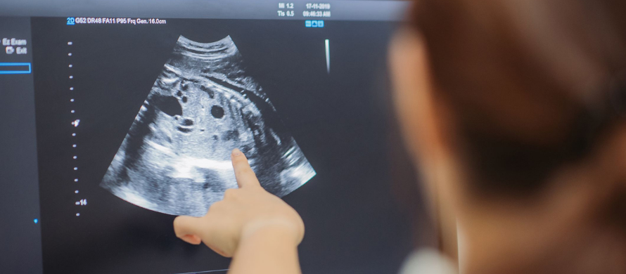 نتایج سونوگرافی در اوایل بارداری به چه صورت است؟
