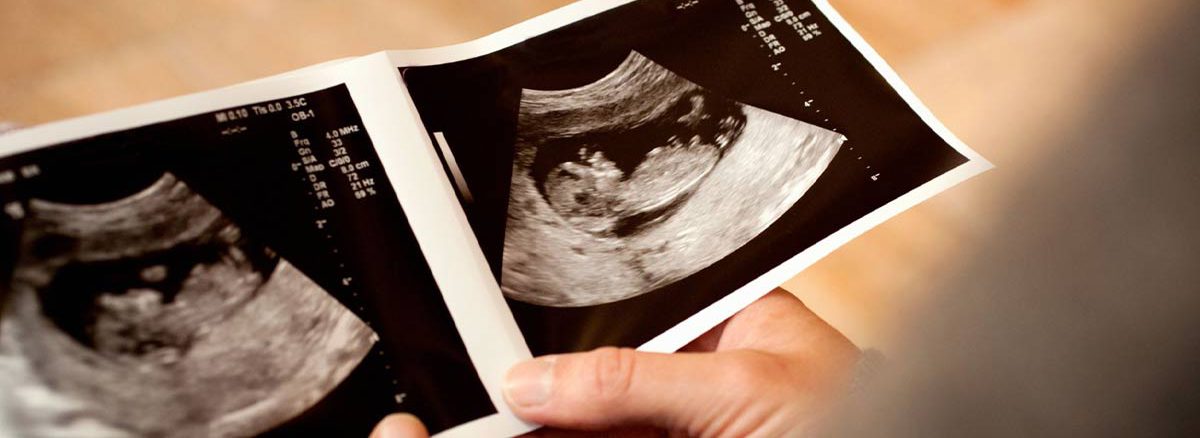 تفاوت جنین دختر و پسر در سونوگرافی هفته 12 در چیست؟ + عکس