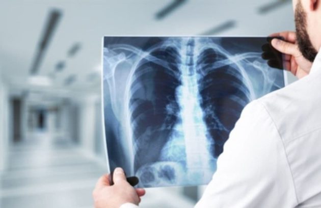 عوارض رادیولوژی غیرضرروی؛ فرق رادیولوژی و رادیوگرافی چیست؟