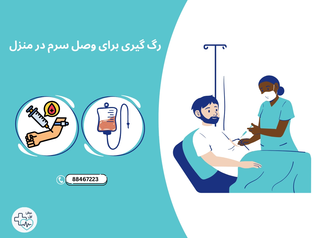 نحوه رگ گیری برای وصل سرم در منزل