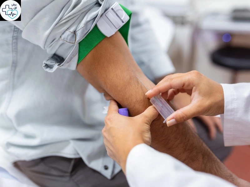 فصد خون در منزل