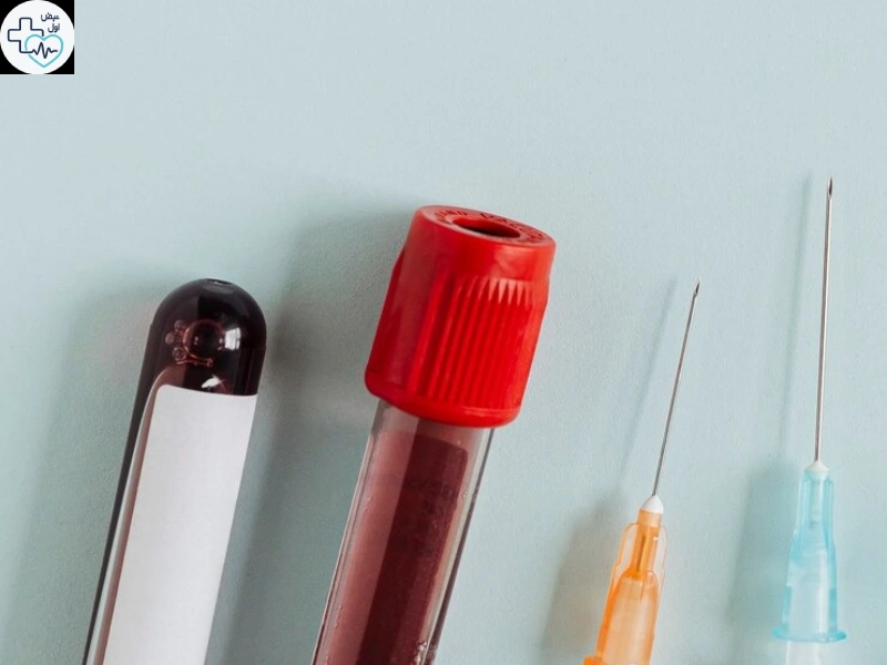 چرا باید فصد خون در منزل را انجام داد؟