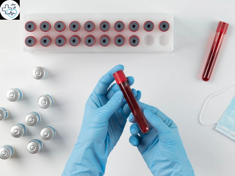 تاثیر فصد خون بر غلظت خون چقدر است؟